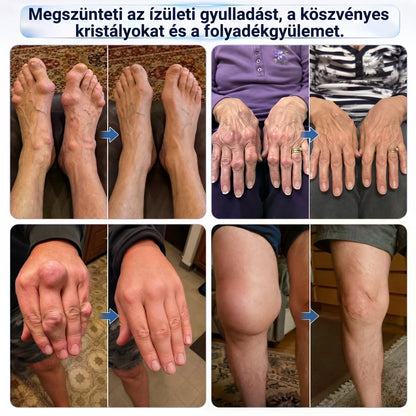 💥💥DR.HONOR® Menthol · Arnika · Ďáblův dráp 10 v 1 Roll-on pro péči o klouby a svaly | Na dnu, ztuhlost kloubů, otoky a bolesti svalů | Rychle se vstřebává, nezanechává mastný pocit