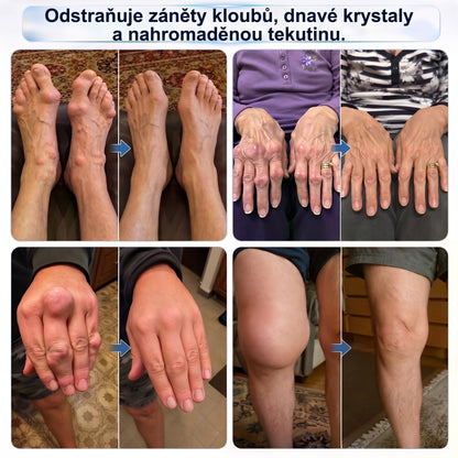 Zbývá už jen 5 krabic! Nabízíme extra 30% slevu! Využijte speciální nabídku a objednejte si nyní za zvýhodněnou cenu!