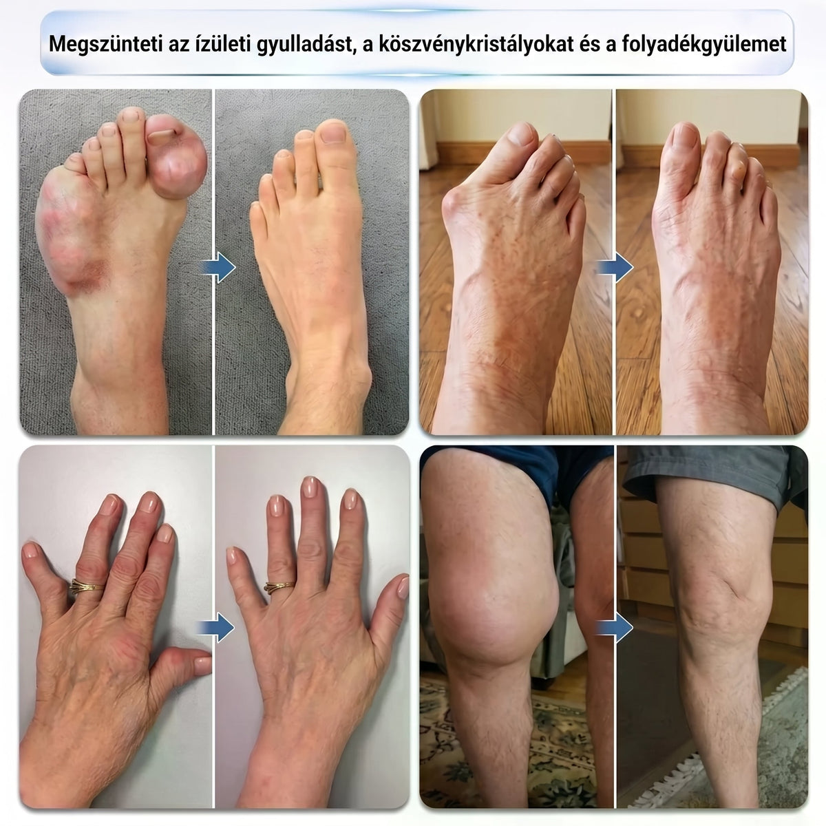 💥💥DR.HONOR® Menthol · Arnika · Ďáblův dráp 10 v 1 Roll-on pro péči o klouby a svaly | Na dnu, ztuhlost kloubů, otoky a bolesti svalů | Rychle se vstřebává, nezanechává mastný pocit