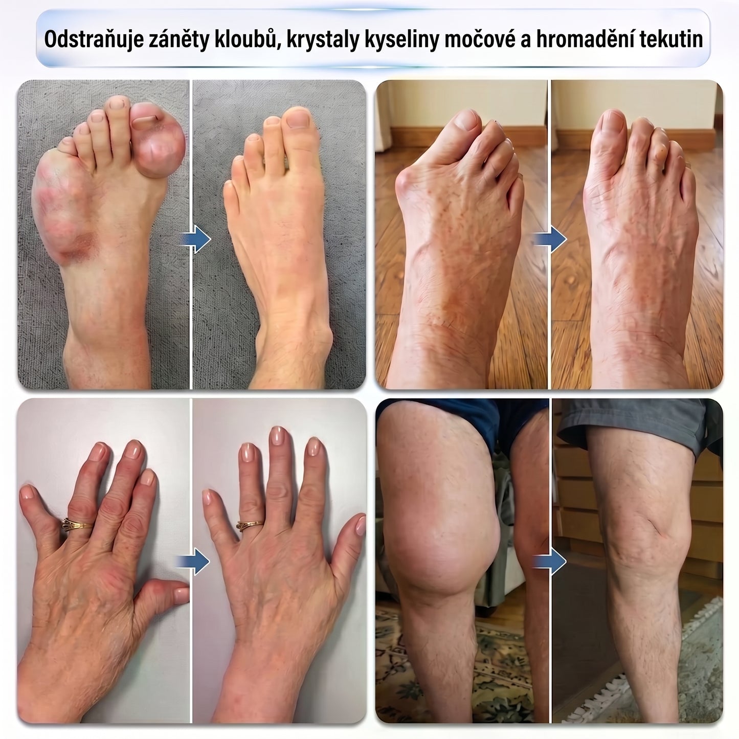 Zbývá už jen 5 krabic! Nabízíme extra 30% slevu! Využijte speciální nabídku a objednejte si nyní za zvýhodněnou cenu!